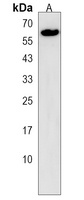 Anti-MAGED2 Antibody