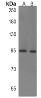 Anti-ENAM Antibody