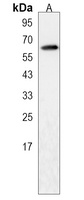 Anti-RTKN2 Antibody