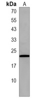 Anti-LOH12CR1 Antibody