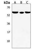 Anti-SOWAHC Antibody