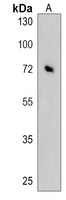 Anti-KLHL6 Antibody