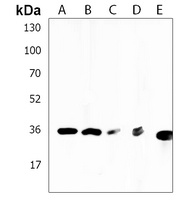 Anti-RCN3 Antibody