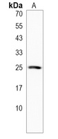 Anti-LHFPL3 Antibody
