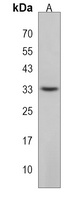 Anti-RSPO4 Antibody