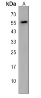 Anti-ALG10B Antibody