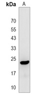 Anti-RBM24 Antibody
