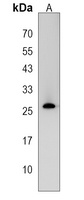 Anti-CRISPLD2 Antibody