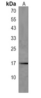Anti-C1orf95 Antibody