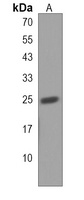 Anti-PLET1 Antibody