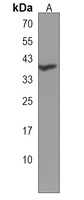 Anti-LMX1A Antibody