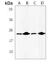 Anti-IL-24 Antibody