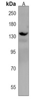 Anti-ATP2B3 Antibody