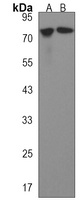 Anti-AACS Antibody