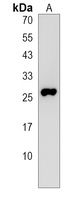 Anti-NOTO Antibody