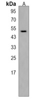 Anti-HS6ST2 Antibody