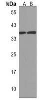 Anti-B4GALT7 Antibody