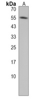 Anti-RBCK1 Antibody