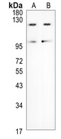 Anti-LIFR Antibody