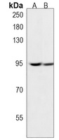 Anti-KDM1B Antibody