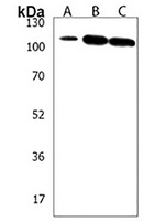 Anti-SKOR2 Antibody