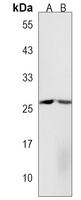 Anti-CXCL16 Antibody