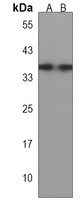 Anti-DBX1 Antibody