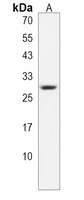 Anti-COX11 Antibody