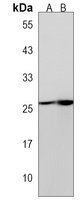 Anti-CYB5R2 Antibody