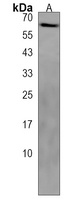 Anti-PET112 Antibody