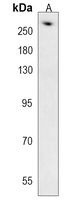 Anti-AHCTF1 Antibody