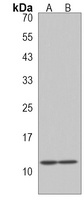 Anti-SNRPG Antibody