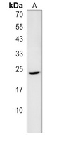 Anti-IZUMO2 Antibody