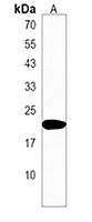 Anti-FATE1 Antibody