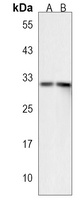 Anti-XAF1 Antibody