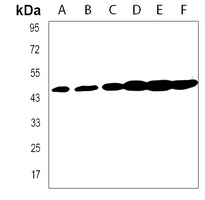 Anti-GDF11 Antibody