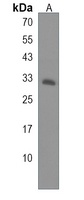 Anti-CRX Antibody