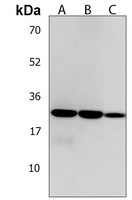 Anti-FAM216B Antibody