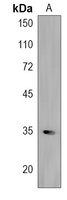 Anti-FBXL17 Antibody