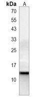 Anti-HBG2 Antibody