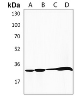 Anti-HLA-DRB1 Antibody