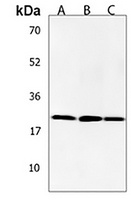 Anti-ANP32E Antibody