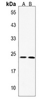 Anti-MMAB Antibody