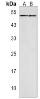 Anti-SLC25A25 Antibody