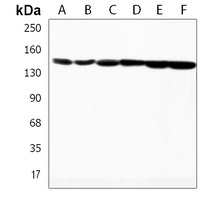 Anti-Plakophilin 4 Antibody