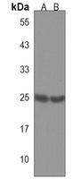 RAB3C Rabbit Polyclonal Antibody