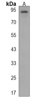 Anti-Matrilin 2 Antibody