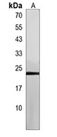 Anti-BLOC1S4 Antibody