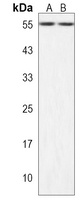 Anti-ZSCAN32 Antibody