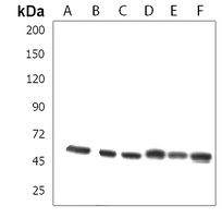 Anti-ZRSR2 Antibody